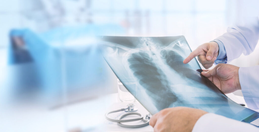 Sports Injury Care in Singapore - The Orthopaedic Practice And Surgery Sports Injury Care in Singapore